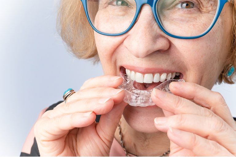 A happy elderly woman puts on transparent removable braces. Cosmetic dentistry for all ages