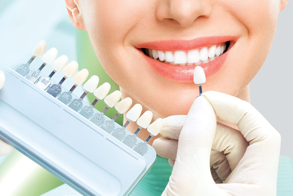 Close up portrait of Young women in dentist chair, Check and select the color of the teeth. Dentist makes the process of treatment in dental clinic office. Teeth whitenning.
